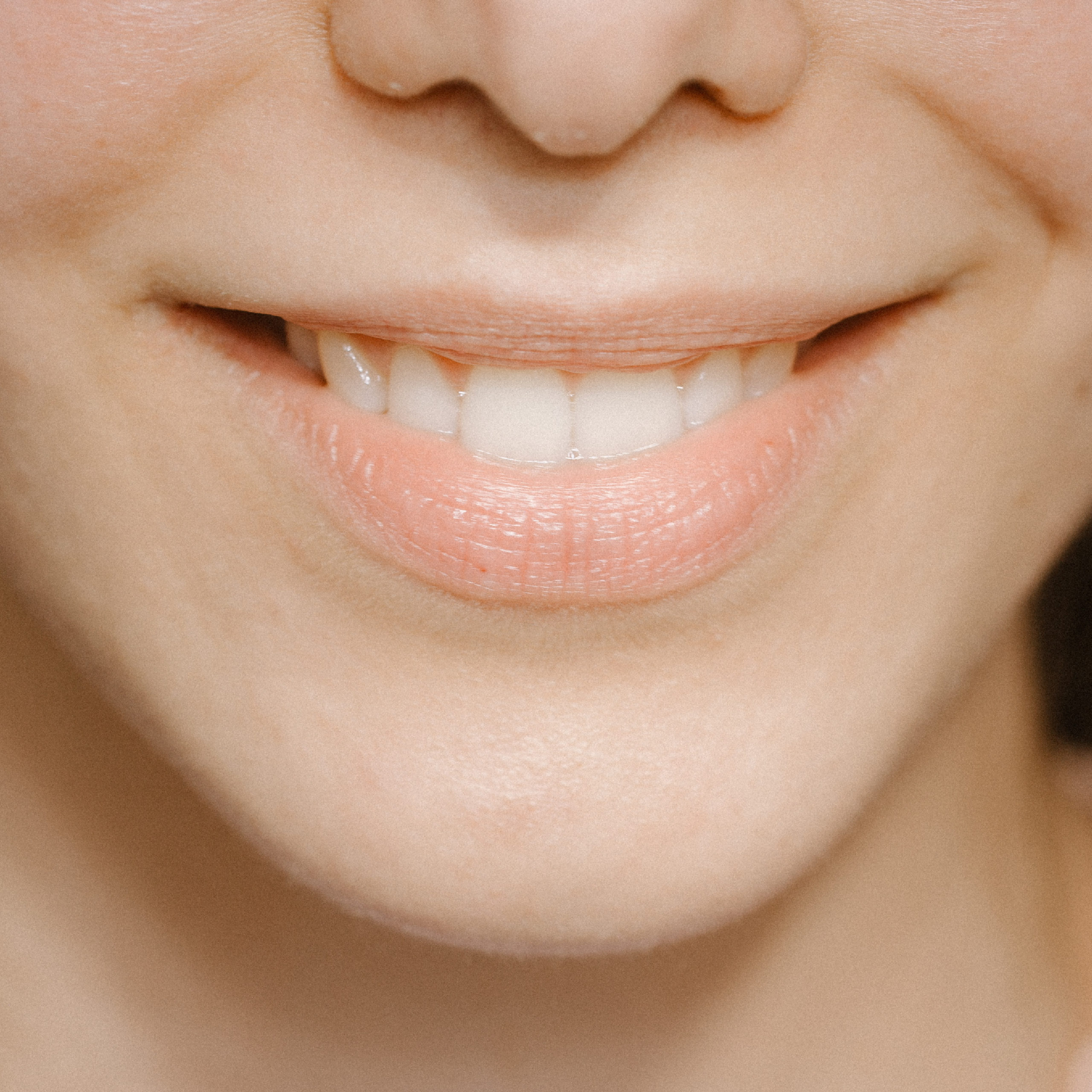FOTO WEB KVADRATNI FORMAT HQ (7) dental margic