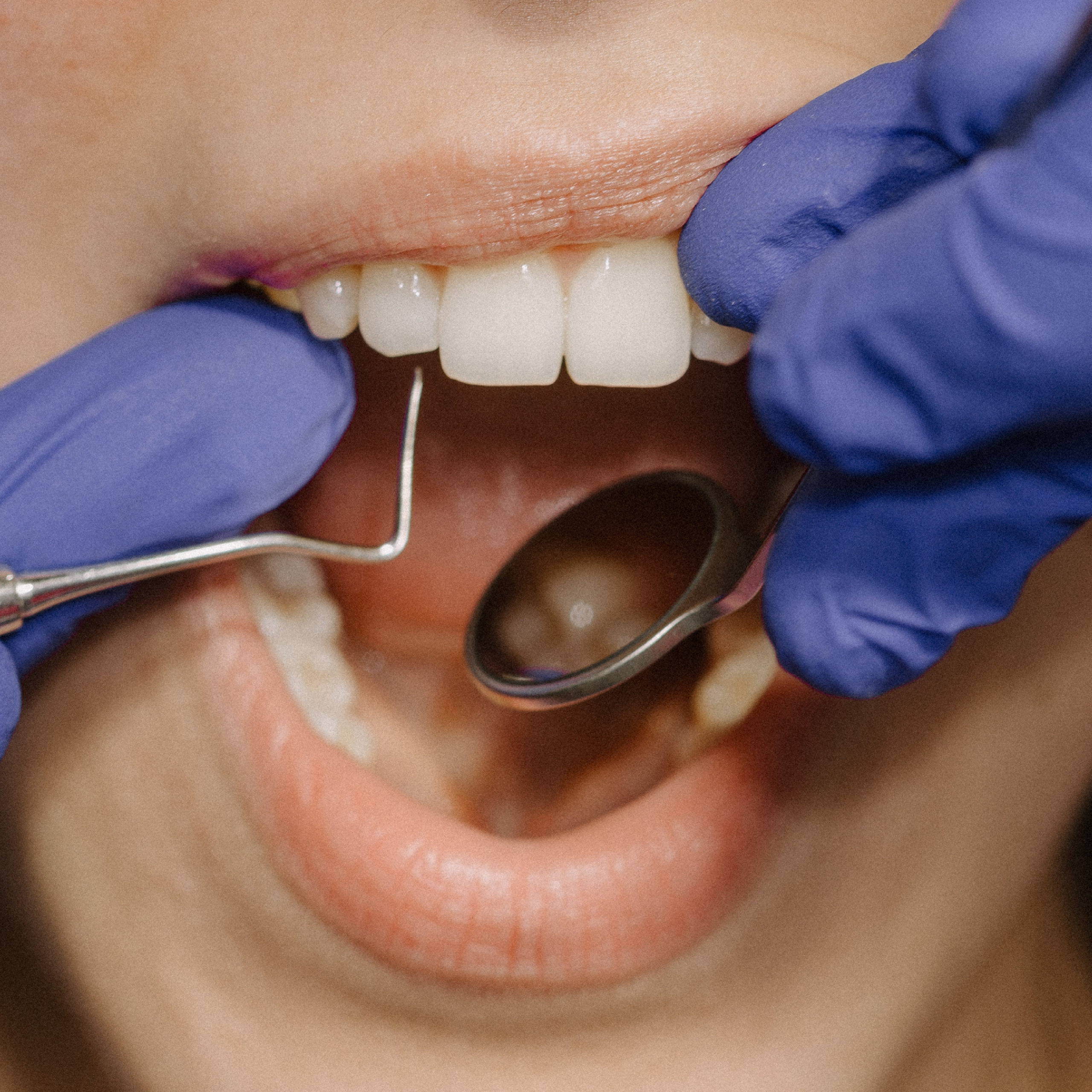 FOTO WEB KVADRATNI FORMAT HQ (8) Dental-Margic-69